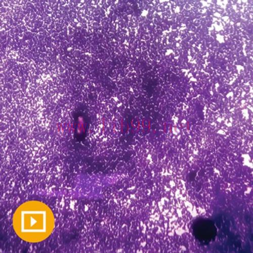 [AME]Cytopathology 2022 (CME VIDEOS)