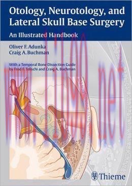[AME]Otology, Neurotology, and Lateral Skull Base Surgery: An Illustrated Handbook