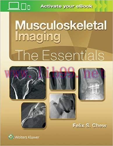 [EPUB]Musculoskeletal Imaging - The Essentials [Felix S. Chew]
