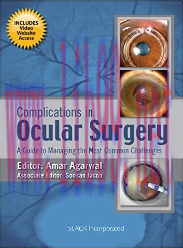 [PDF]Complications in Ocular Surgery A Guide to Managing the Most Common Challenges
