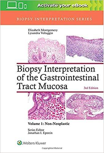 Biopsy Interpretation of the Gastrointestinal Tract Mucosa Volume 1 Non-Neoplastic， 3rd Edition