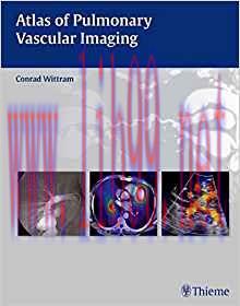 [PDF]Atlas of Pulmonary Vascular Imaging