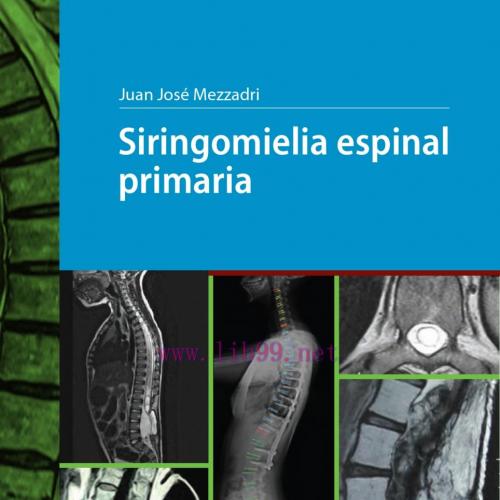 [AME]Siringomielia espinal primaria (High Quality Image PDF)