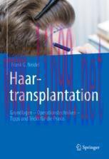 [PDF]Haartransplantation: Grundlagen &ndash; Operationstechniken &ndash; Tipps und Tricks f&uuml;r die Praxis