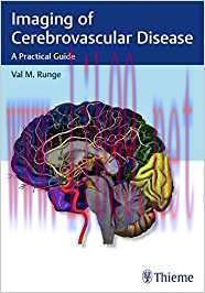 [PDF]Imaging of Cerebrovascular Disease