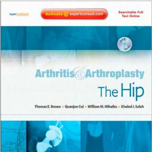 Arthritis and Arthroplasty The Hip,1e