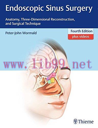 [AME]Endoscopic Sinus Surgery: Anatomy, Three-Dimensional Reconstruction, and Surgical Techniqu...