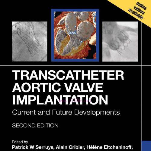 [AME]Transcatheter Aortic Valve Implantation: Current and Future Developments, 2nd Edition (EPU...