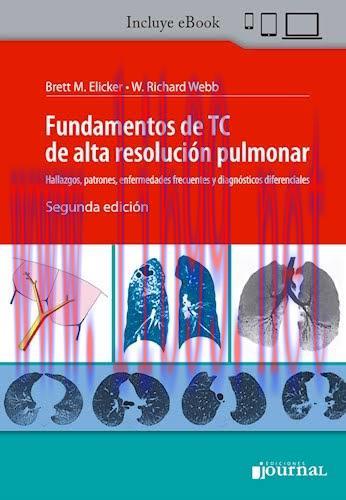[AME]Fundamentos De Tc De Alta Resolucion Pulmonar Hallazgos, 2&ordf; edici&oacute;n (High Quality Image PD...