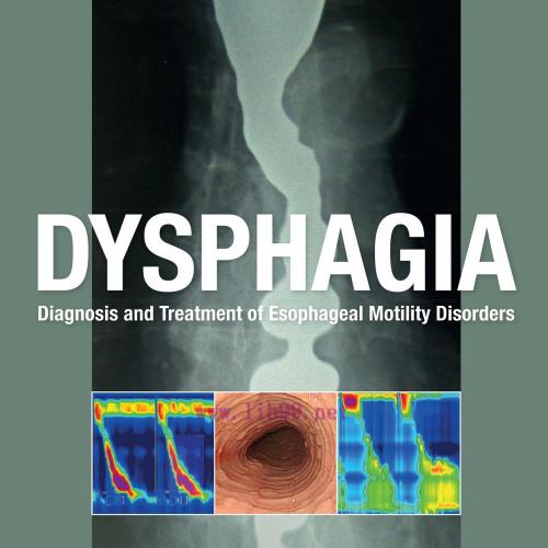 [AME]Dysphagia: Diagnosis and Treatment of Esophageal Motility Disorders (EPUB)