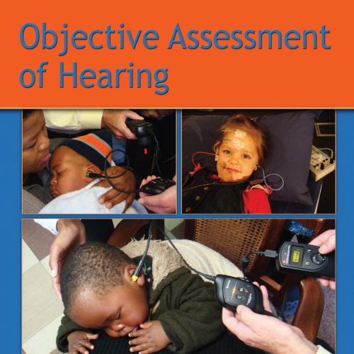 Objective Assessment of Hearing