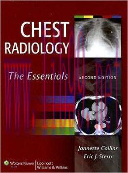 [AME]Chest Radiology: The Essentials, 2nd Edition (ORIGINAL PDF from_ Publisher)