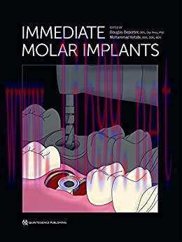 [AME]Immediate Molar Implants (Original PDF)