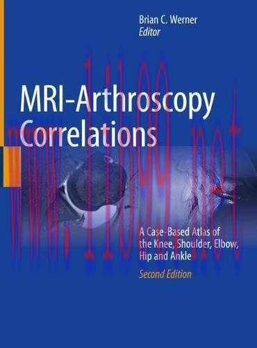 [AME]MRI-Arthroscopy Correlations: A Case-Based Atlas of the Knee, Shoulder, Elbow, Hip and Ank...