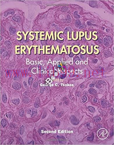 [PDF]Systemic Lupus Erythematosus 2nd edition