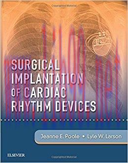 [AME]Surgical Implantation of Cardiac Rhythm Devices, 1e (PDF)