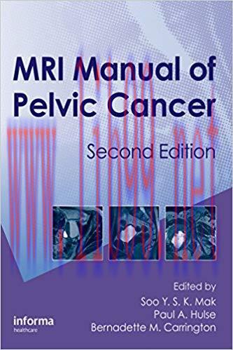 (PDF)MRI Manual of Pelvic Cancer 2nd Edition