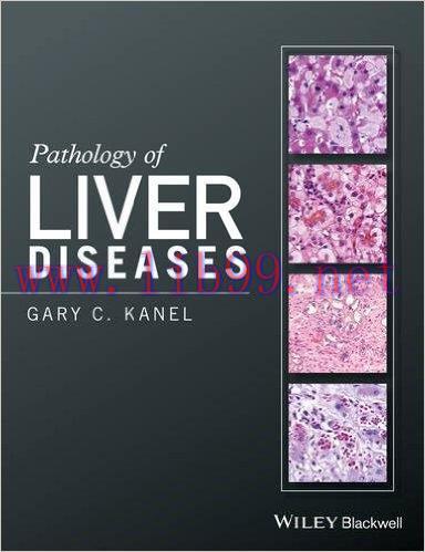 [AME]Pathology of Liver Diseases