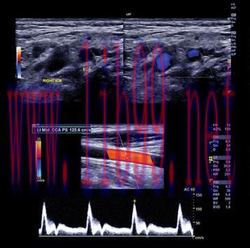 [AME]Clinical Approach to Vascular Ultrasound and RPVI Prep Course 2021 (CME VIDEOS)
