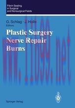 [PDF]Fibrin Sealing in Surgical and Nonsurgical Fields: Volume 3: Plastic Surgery Nerve Repair ...
