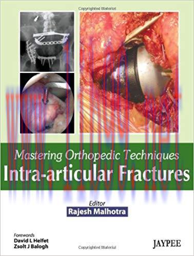 [PDF]Mastering Orthopedic Techniques Intra-Articular Fractures