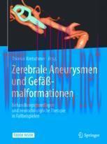 [PDF]Zerebrale Aneurysmen und Gef&auml;&szlig;malformationen: Behandlungsgrundlagen und neurochirurgische ...
