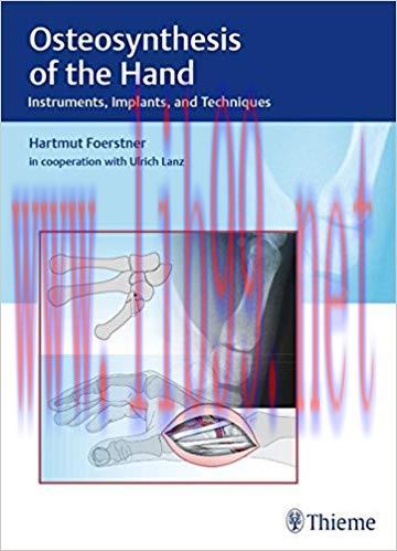 [PDF]Osteosynthesis of the Hand - Instruments, Implants, and Techniques