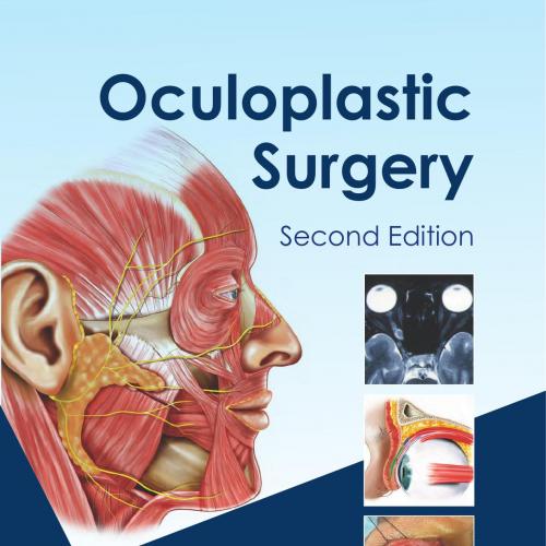 Oculoplastic Surgery, 2nd Edition