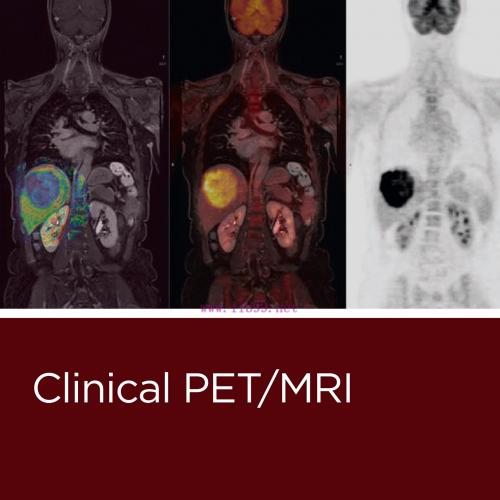 [AME]Clinical PET/MRI (EPUB)