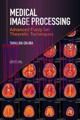 [AME]Medical Image Processing: Advanced Fuzzy Set Theoretic Techniques