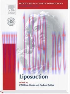 [AME]Procedures in Cosmetic Dermatology Series: Liposuction (Original PDF)