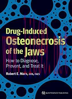 [PDF]Drug-Induced Osteonecrosis of the Jaws: How to Diagnose, Prevent, and Treat It