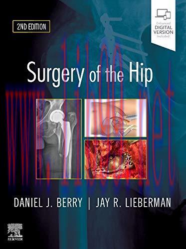 [AME]Surgery of the Hip, 2nd Edition (EPUB)