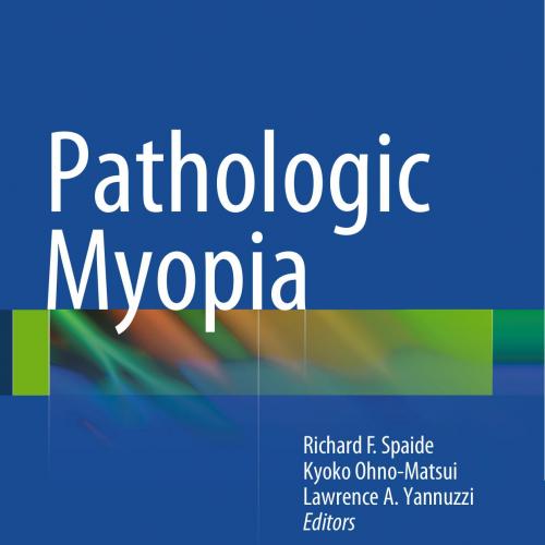 Pathologic Myopia