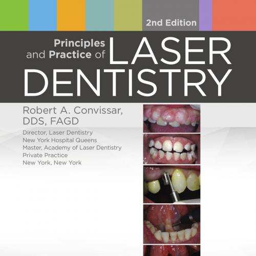 Principles and Practice of Laser Dentistry, 2nd Edition