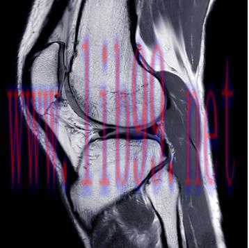 [AME]UCSF Neuro and Musculoskeletal Imaging 2022 (Videos)