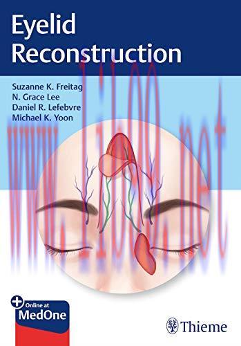 [AME]Eyelid Reconstruction (Original PDF)