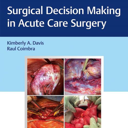 [AME]Surgical Decision Making in Acute Care Surgery (EPUB)