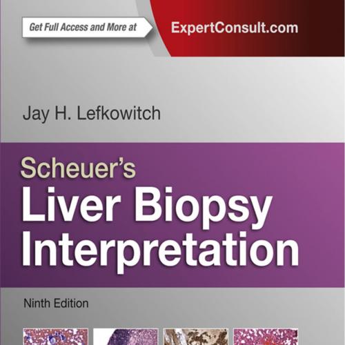 Scheuer's Liver Biopsy Interpretation