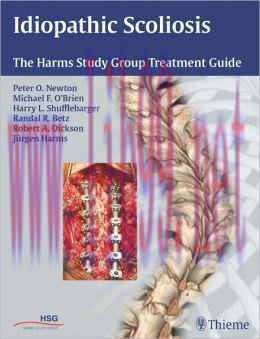 [AME]Idiopathic Scoliosis: The Harms Study Group Treatment Guide