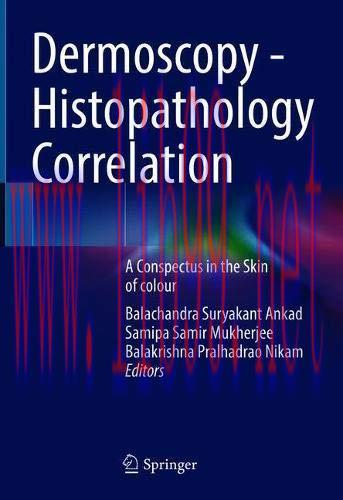 [AME]Dermoscopy &ndash; Histopathology Correlation: A Conspectus in the Skin of colour (Original PDF)