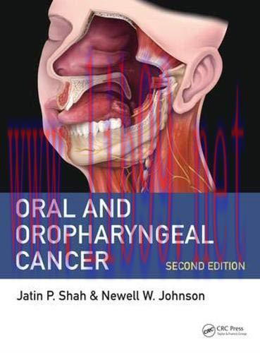 [AME]Oral and Oropharyngeal Cancer, 2nd Edition (PDF)