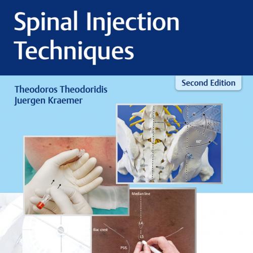 Thieme Spinal Injection Techniques 2nd Edition