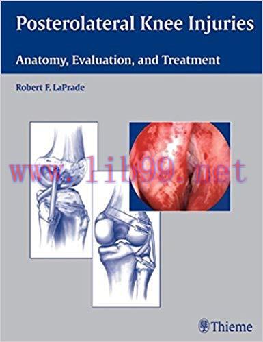 [PDF]Posterolateral Knee Injuries