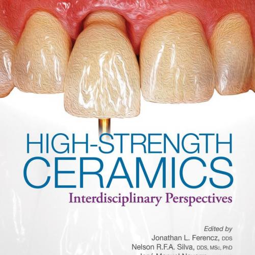 High-Strength Ceramics Interdisciplinary Perspectives