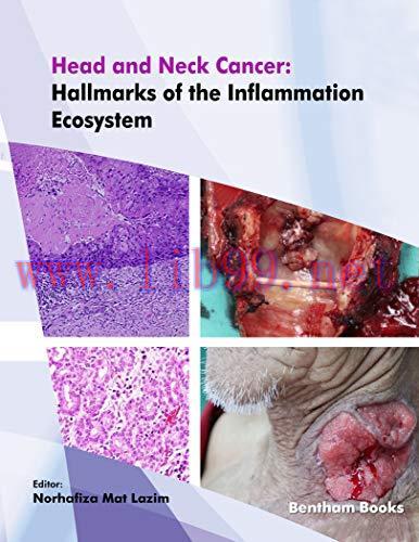 [PDF]Head and Neck Cancer Hallmarks of the Inflammation Ecosystem
