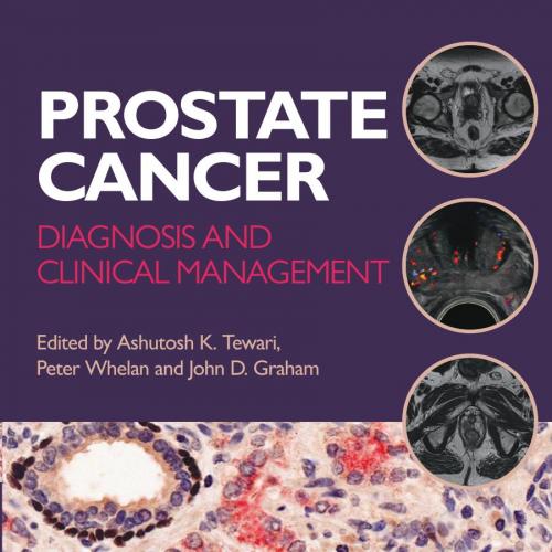 Prostate Cancer Diagnosis and Clinical Management