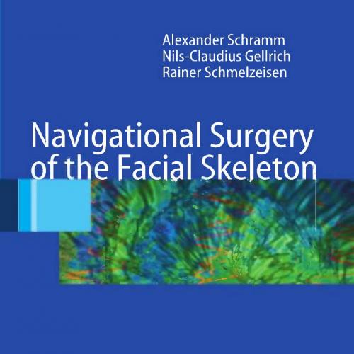 Navigational Surgery of the Facial Skeleton
