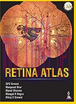 [PDF]Retina Atlas [Manpreet Brar]