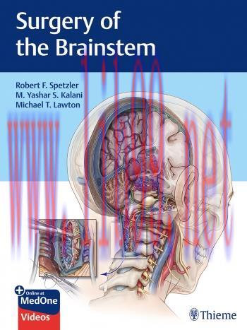 [AME]Surgery of the Brainstem (Original PDF)
